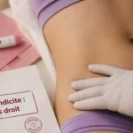 Appendicite quel coté : douleur bas droit avec fièvre et nausées